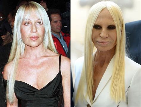 donatella versace caratteristixhe stile|donatella versace before and after surgery.